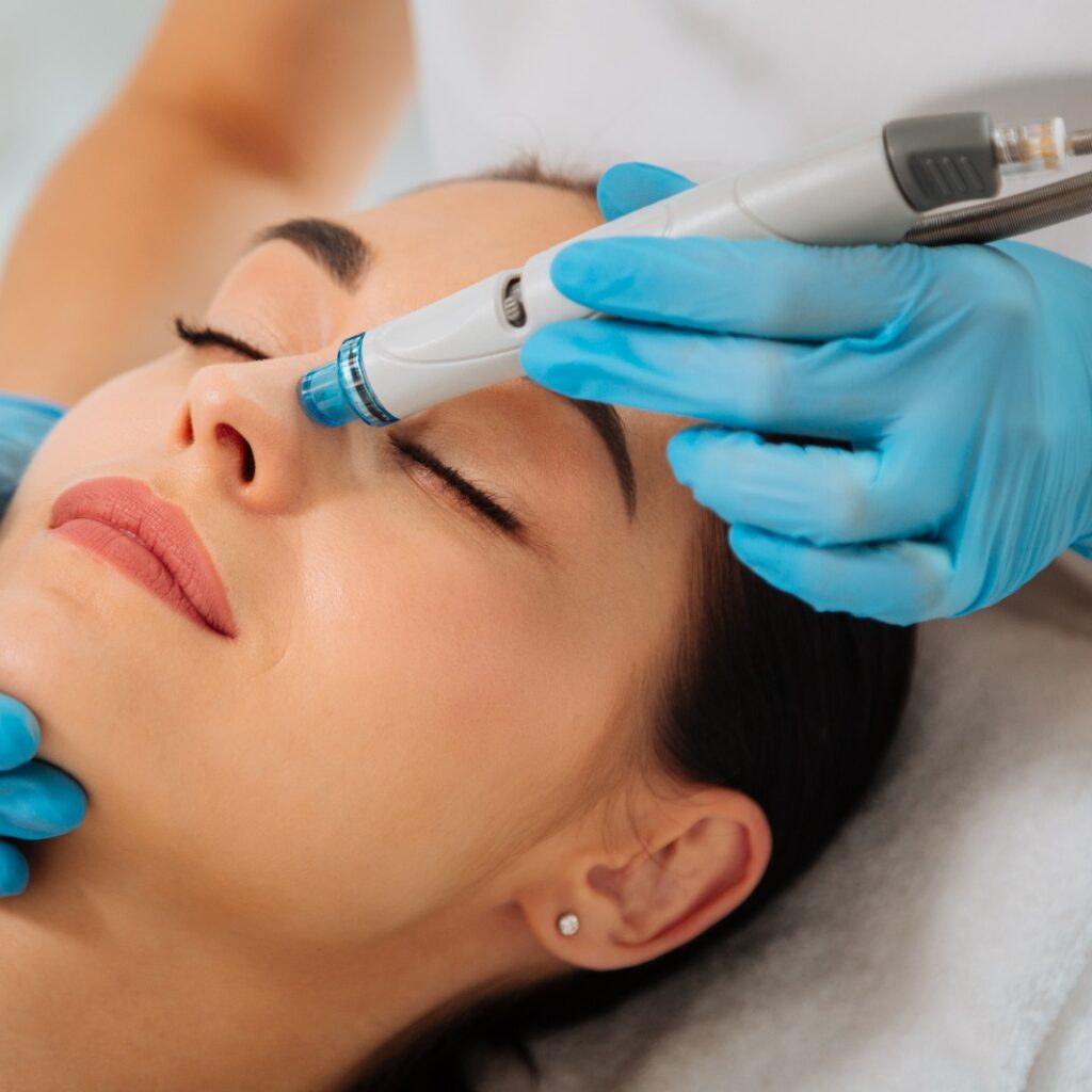 Microneedling Facial in Columbia, MD - Best Skincare Clinic