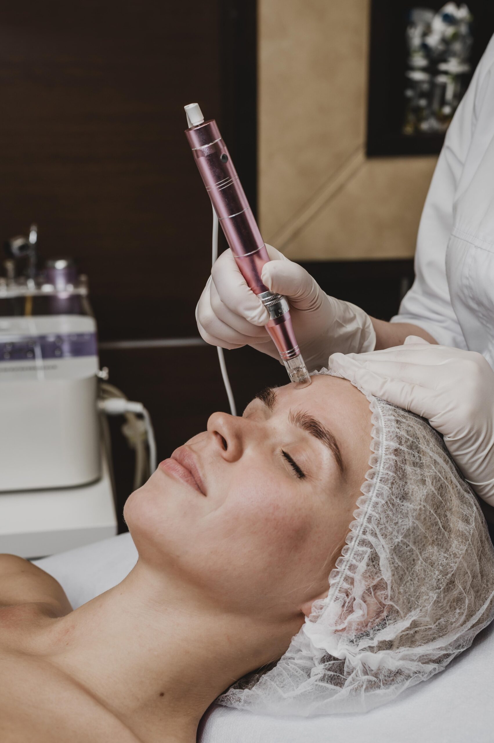 Micro-needling Treatment for Glowing Skin | Microneedling With PRF in Columbia, MD