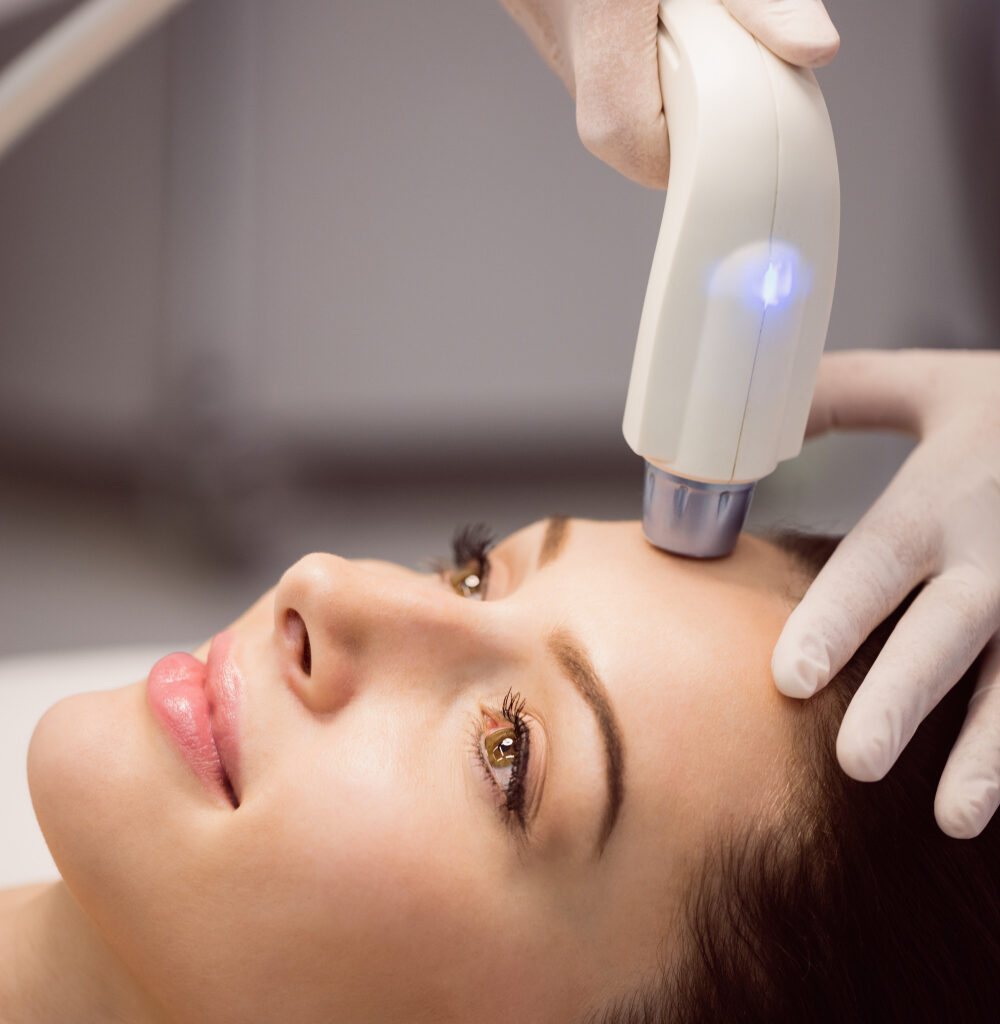 Female laser hair remove